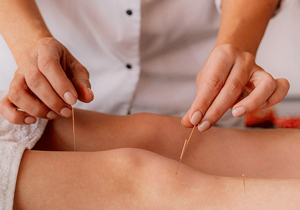 Acupuncture Clinic in London, Ontario
