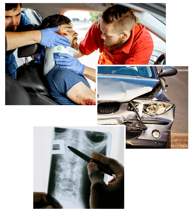 Car Accident Physiotherapy London, Ontario
