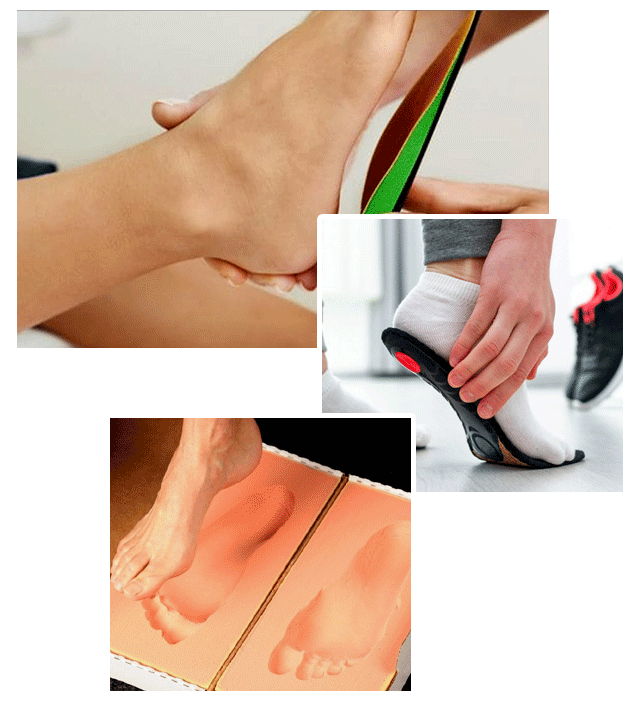 Custom Foot Orthotics in London, Ontario